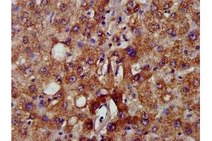 IHC image of ABIN7160839 diluted at 1:500 and staining in paraffin-embedded human liver tissue performed on a Leica BondTM system. (NADK2 antibody  (AA 16-156))