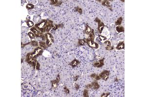 IHC analysis of CKB using anti-CKB antibody . (CKB antibody  (AA 7-381))