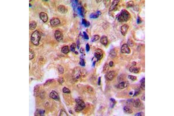 RDM1 antibody  (Center)