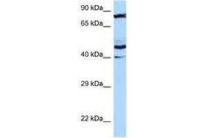Image no. 1 for anti-Mitochondrial Ribosomal Protein S31 (MRPS31) (AA 34-83) antibody (ABIN6747362) (MRPS31 antibody  (AA 34-83))