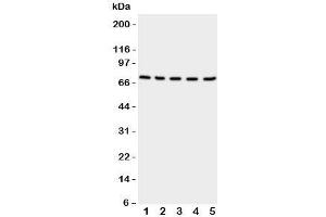 Western blot testing of NRG1 antibody and Lane 1: rat spleen;  2: (r) kidney;  3: (r) brain;  4: human HeLa;  5: (h) SMMC-7721 cell lysate (Neuregulin 1 antibody  (C-Term))