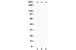 Western blot testing of human 1) HeLa, 2) MCF7 and 3) SW620 cell lysate with MGA antibody.