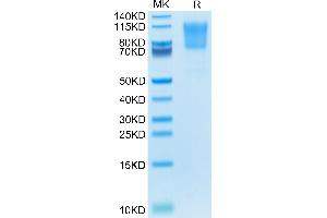 Human PSGL-1 on Tris-Bis PAGE under reduced condition. (SELPLG Protein (AA 42-320) (His tag))