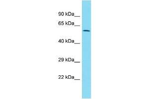Host:  Rabbit  Target Name:  ZNF671  Sample Type:  Uterus Tumor lysates  Antibody Dilution:  1. (ZNF671 antibody  (C-Term))