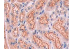 IHC-P analysis of Rat Kidney Tissue, with DAB staining. (CUBN antibody  (AA 98-207))