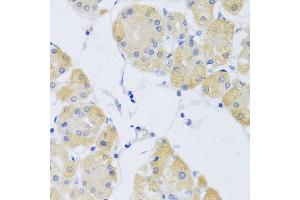 Immunohistochemistry of paraffin-embedded human stomach using CLIP1 antibody at dilution of 1:100 (x40 lens). (CLIP1 antibody)