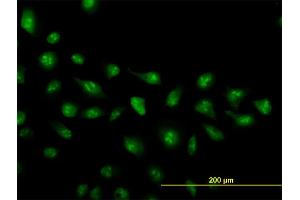 Immunofluorescence of monoclonal antibody to ZIC4 on HeLa cell. (ZIC4 antibody  (AA 249-319))