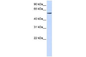 WB Suggested Anti-ZNF358 Antibody Titration: 0.