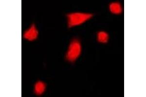 Immunofluorescent analysis of DGK iota staining in HeLa cells. (DGKI antibody  (C-Term))