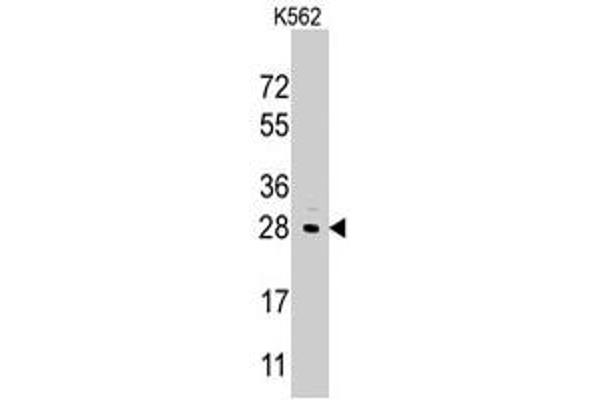 LIN28B Antikörper  (Internal Region)