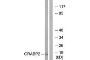 Western blot analysis of extracts from HT-29 cells, using CRABP2 Antibody. (CRABP2 antibody  (AA 41-90))