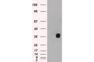HEK293T cells were transfected with the pCMV6-ENTRY control (Left lane) or pCMV6-ENTRY CD2 (Right lane) cDNA for 48 hrs and lysed. (CD2 antibody)