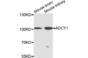 Western blot analysis of extracts of various cells, using ADCY1 antibody. (ADCY1 antibody)