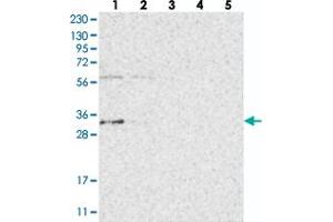 Western blot analysis of Lane 1: RT-4, Lane 2: U-251 MG, Lane 3: Human Plasma, Lane 4: Liver, Lane 5: Tonsil with ZFAND2B polyclonal antibody  at 1:250-1:500 dilution. (ZFAND2B antibody)