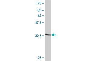 Western Blot detection against Immunogen (31.