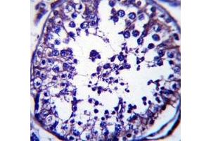 RAB5C antibody immunohistochemistry analysis in formalin fixed and paraffin embedded human testis tissue. (Rab5c antibody  (AA 178-207))