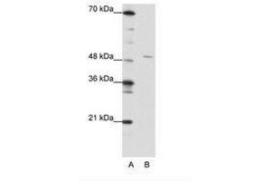 Image no. 1 for anti-High-Mobility Group 20A (HMG20A) (AA 181-230) antibody (ABIN202299)