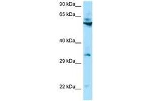 Image no. 1 for anti-Transmembrane Protein 192 (TMEM192) (AA 60-109) antibody (ABIN6748451) (TMEM192 antibody  (AA 60-109))