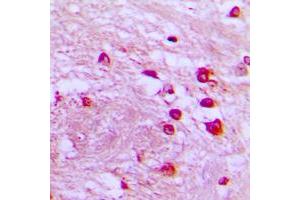Immunohistochemical analysis of p39 staining in human brain formalin fixed paraffin embedded tissue section. (p39 (Center) antibody)