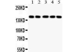 Anti- COL2A1 antibody, Western blotting All lanes: Anti COL2A1  at 0. (COL2A1 antibody  (C-Term))