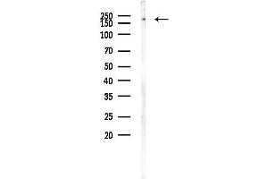 anti-5'-3' Exoribonuclease 1 (XRN1) (N-Term) antibody