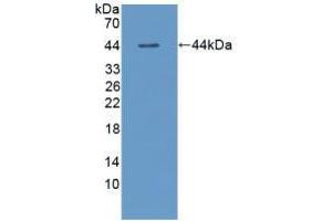 Western blot analysis of recombinant Dog TSHb. (TSHB antibody  (AA 20-138))