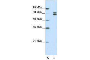 MSH2 antibody used at 1. (MSH2 antibody)