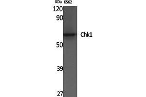 Western Blotting (WB) image for anti-Checkpoint Kinase 1 (CHEK1) (Ser286) antibody (ABIN5961567) (CHEK1 antibody  (Ser286))