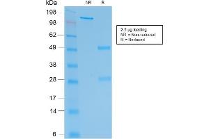 SDS-PAGE Analysis Purified hCG beta Mouse Recombinant Monoclonal Antibody (rHCGb/54). (Recombinant CGB antibody)