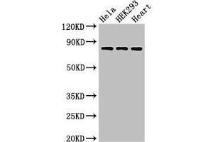 Western Blot Positive WB detected in: Hela whole cell lysate, HEK293 whole cell lysate, Rat heart tissue All lanes: C1R antibody at 3 μg/mL Secondary Goat polyclonal to rabbit IgG at 1/50000 dilution Predicted band size: 81 kDa Observed band size: 81 kDa (C1R antibody  (AA 65-192))