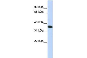 WB Suggested Anti-C21orf59  Antibody Titration: 0. (C21orf59 antibody  (N-Term))