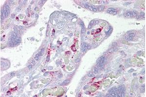 Immunohistochemistry with Placenta tissue at an antibody concentration of 5µg/ml using anti-ING3 antibody (ARP33346_P050) (ING3 antibody  (N-Term))
