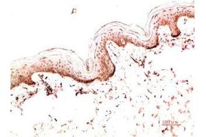 Immunohistochemical analysis of paraffin-embedded Human Skin Tissue using Collagen I Mouse mAb diluted at 1:200. (COL1A1 antibody)