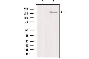 Western blot analysis of extracts from HepG2, using CAMSAP2 Antibody.