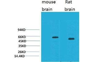 Western Blot (WB) analysis of 1) Mouse Brain Tissue, 2)Rat Brain Tissue with EAAT2 Rabbit Polyclonal Antibody diluted at 1:2000. (SLC1A2 antibody)