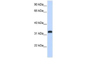 C21ORF62 antibody used at 1 ug/ml to detect target protein.