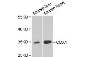 Western blot analysis of extracts of various cell lines, using CDX1 antibody (ABIN2561793) at 1:1000 dilution. (CDX1 antibody)