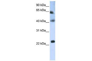 Tetraspanin 3 antibody used at 1 ug/ml to detect target protein.