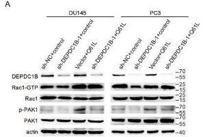 Mutated active Rac1 plasmid (Q61L) recuses the function in DEPDC1B-knockdown cells.