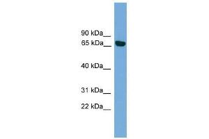 Western Blot showing PRKCI antibody used at a concentration of 1-2 ug/ml to detect its target protein. (PKC iota antibody  (Middle Region))