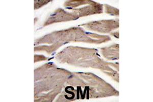 Formalin-fixed and paraffin-embedded human skeletal muscle reacted with PFKM polyclonal antibody  , which was peroxidase-conjugated to the secondary antibody, followed by DAB staining. (PFKM antibody  (C-Term))