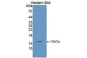 Detection of Recombinant ACYP1, Human using Polyclonal Antibody to Acylphosphatase 1, Erythrocyte (ACYP1) (Acylphosphatase 1, Erythrocyte (AA 1-99) antibody)