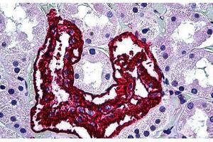 Human Kidney: Formalin-Fixed, Paraffin-Embedded (FFPE) (Inhibin alpha antibody)