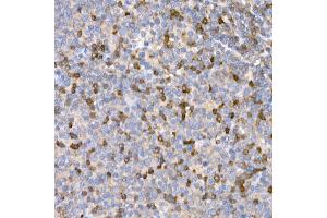 Immunohistochemistry (IHC) image for anti-Lymphotoxin beta Receptor (TNFR Superfamily, Member 3) (LTBR) (AA 31-227) antibody (ABIN6143379)