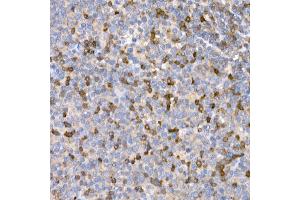 Immunohistochemistry of paraffin-embedded human tonsil using LTBR Rabbit pAb (ABIN6129412, ABIN6143379, ABIN6143381 and ABIN6220987) at dilution of 1:25 (40x lens). (LTBR antibody  (AA 31-227))