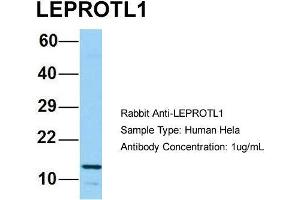 Host: Rabbit Target Name: LEPROTL1 Sample Type: Human Hela Antibody Dilution: 1.