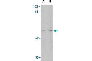Western blot analysis of LGI4 in rat brain tissue lysate with LGI4 polyclonal antibody  at (A) 1 and (B) 2 ug/mL .
