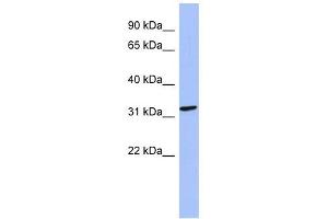 MAGEB2 antibody used at 1 ug/ml to detect target protein.