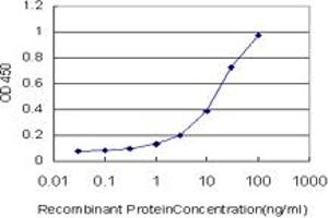 Detection limit for recombinant GST tagged HDAC8 is approximately 0. (HDAC8 antibody  (AA 1-377))