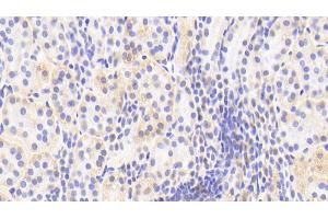 Detection of APPBP1 in Human Kidney Tissue using Polyclonal Antibody to Amyloid Beta Precursor Protein Binding Protein 1 (APPBP1) (Amyloid beta Precursor Protein Binding Protein 1 (AA 229-534) antibody)